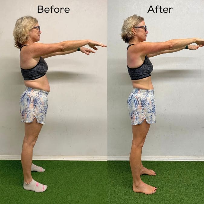 charlotte before and after